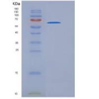 人成纤维细胞生长因子受体4(FGFR4)重组蛋白His & Fc tag