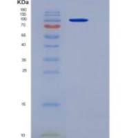 人DPP4 / DPPIV / CD26重组蛋白Fc tag