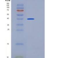 小鼠CD83 / HB15重组蛋白Fc tag
