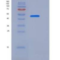 人TNFR1 / CD120a / TNFRSF1A重组蛋白His & Fc tag