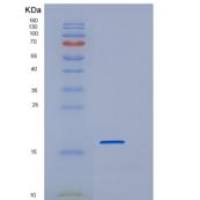 人REG1A / PSPS重组蛋白His tag