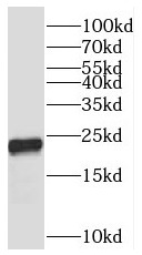PXMP2 antibody|PXMP2抗体