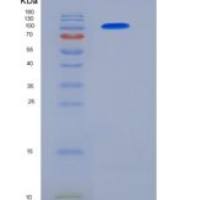 人血管紧张素转化酶2(ACE2)重组蛋白Fc Tag