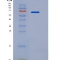 人E-Selectin / CD62e / SELE重组蛋白His tag