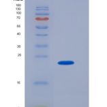 小鼠SLAMF7/CD319重组蛋白His Tag