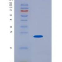 小鼠SLAMF7/CD319重组蛋白His Tag