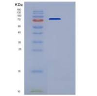 人BACE1 / ASP2重组蛋白Fc tag