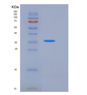 人PTPN2 / PTPT重组蛋白