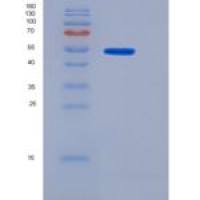 人醛脱氢酶3家族成员A1(ALDH3A1)重组蛋白His Tag
