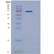 人HSPA8 / HSC70重组蛋白His tag