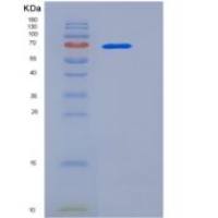 人HSPA8 / HSC70重组蛋白His tag