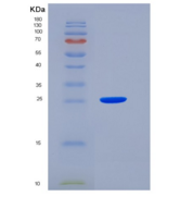 小鼠JAM3 / JAM-C重组蛋白His tag