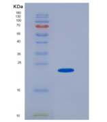 小鼠SLAMF7/CD319重组蛋白His Tag
