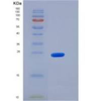 小鼠JAM2 / CD322 / VE-JAM重组蛋白His tag