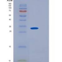 小鼠CD19 / Leu-12重组蛋白His tag