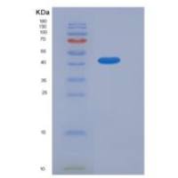 小鼠SerpinA7 / TBG重组蛋白His tag
