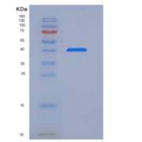 人Frizzled-4 / FZD4 / CD344重组蛋白Fc tag