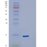 人S100钙结合蛋白A5(S100A5)重组蛋白His tag