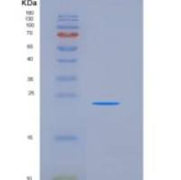 小鼠CD16重组蛋白His Tag