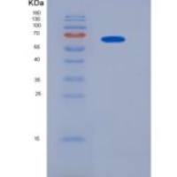 小鼠VE-Cadherin / CD144 / CDH5重组蛋白His tag