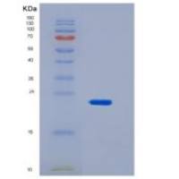 小鼠CD32 / FCGR2B重组蛋白His & AVI tag
