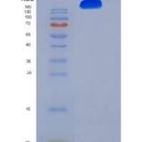 人ITGA5 & ITGB1 Heterodimer重组蛋白