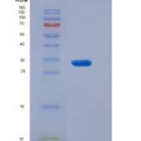 人NEGR1重组蛋白His tag