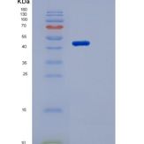 人MSR1 / SCARA1 / CD204重组蛋白His tag