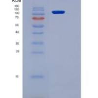 小鼠VEGFR2 / Flk-1 / CD309 / KDR重组蛋白Fc tag