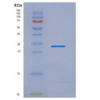 人CD68 / Macrosialin / Gp110重组蛋白aa 1-319, His tag