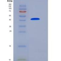 小鼠SerpinA3c重组蛋白His tag