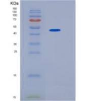 小鼠血红素结合蛋白(HPX)重组蛋白His tag