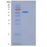 人VSIG4重组蛋白Fc tag