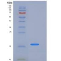 人REG4 / RELP / GISP重组蛋白His tag