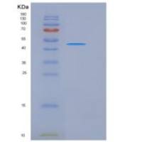 小鼠CD147 / EMMPRIN / Basigin重组蛋白His & Fc tag