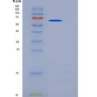 小鼠CES3 / Carboxylesterase-3 / CES1D重组蛋白His tag