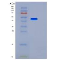 小鼠羧肽酶B2(CPB2)重组蛋白His tag