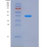 人LAMP1 / CD107a重组蛋白His tag