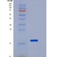 人卷曲同源物10(FZD10)重组蛋白His tag