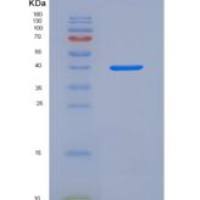 小鼠ALK-2 / ACVR1重组蛋白His & Fc tag