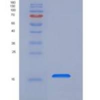 人Frizzled-4 / FZD4 / CD344重组蛋白His Tag