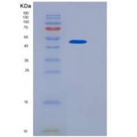 小鼠NGFR / P75重组蛋白Fc tag