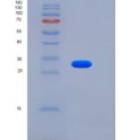 人LSAMP重组蛋白His Tag