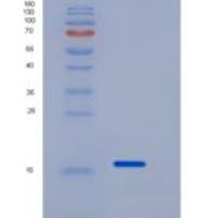 人CD160分子(CD160)重组蛋白His tag