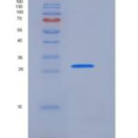 人14-3-3 epsilon / YWHAE重组蛋白