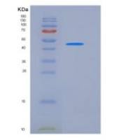 人2B4 / SLAMF / CD244重组蛋白Fc tag