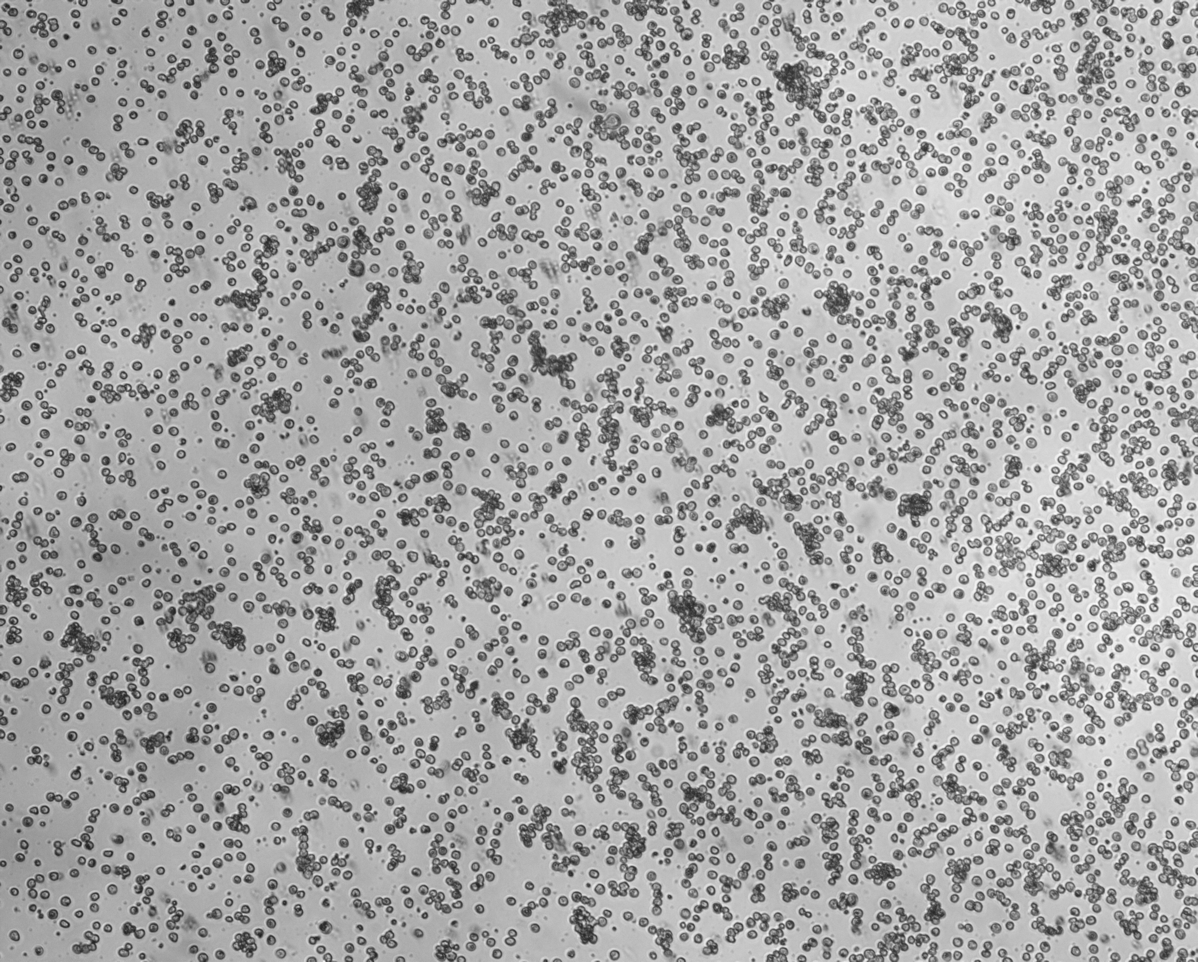 细胞攻略 | Kasumi-1(人急性原粒细胞白血病细胞)培养教程