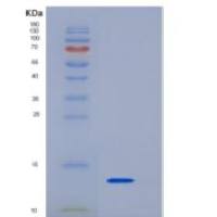 小鼠S100钙结合蛋白A13(S100A13)重组蛋白His tag