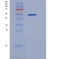 人DPP7 / DPPII / DPP2重组蛋白His tag