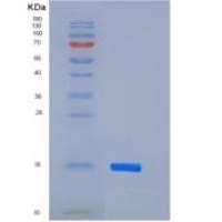 小鼠ACTRIIB / ACVR2B重组蛋白His tag